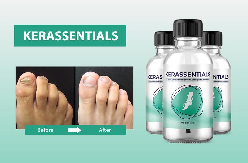 Kerassentials benefits
